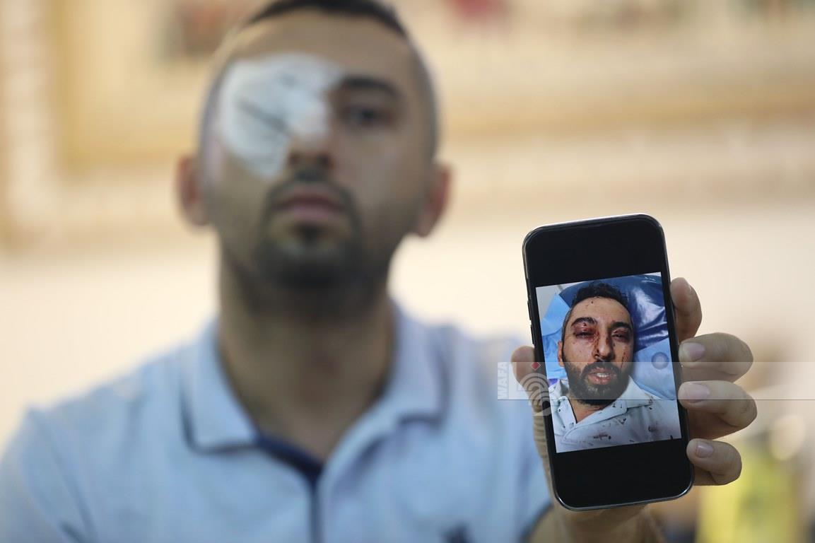 تصوير - أيمن نوباني/وفا